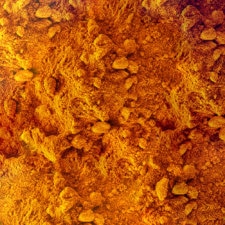 Curcumin